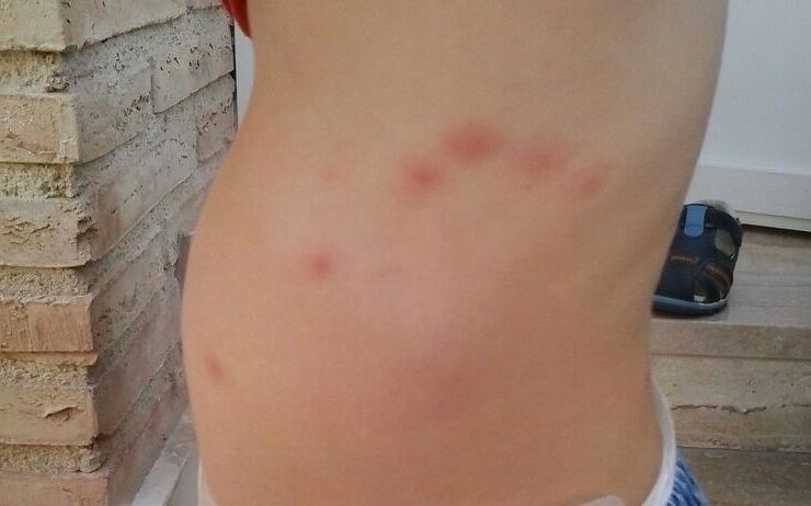 El PSOE exige al Ayuntamiento de Murcia que tome las medidas necesarias para acabar con la plaga de mosquitos